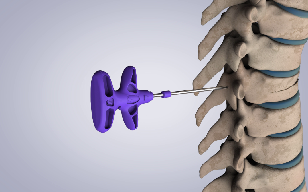 Film Médical 3D : un cas particulier